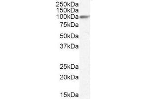 Image no. 3 for anti-Heat Shock Protein 90kDa beta (Grp94), Member 1 (HSP90B1) (Internal Region) antibody (ABIN185655)