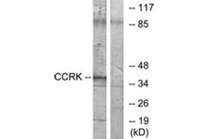 Image no. 1 for anti-Cyclin-Dependent Kinase 20 (CDK20) (AA 31-80) antibody (ABIN1533995)
