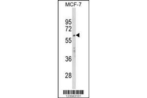 Image no. 1 for anti-APEX Nuclease (Apurinic/apyrimidinic Endonuclease) 2 (APEX2) (AA 143-171) antibody (ABIN652924)