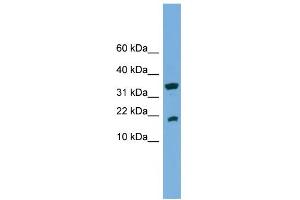 Image no. 1 for anti-Acid Phosphatase 1, Soluble (ACP1) (Middle Region) antibody (ABIN2775360)