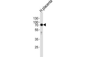 Image no. 3 for anti-Alkaline Phosphatase (ALP) antibody (ABIN2998256)