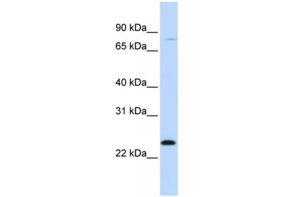 anti-Myxovirus Resistance Protein 1 (MX1) (C-Term) antibody