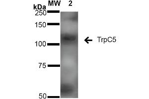 Western Blotting (WB) image for anti-Transient Receptor Potential Cation Channel, Subfamily C, Member 5 (TRPC5) (AA 827-845) antibody (FITC) (ABIN2485379)