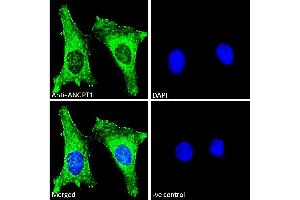 Image no. 4 for anti-Angiopoietin 1 (ANGPT1) (Internal Region) antibody (ABIN768552)