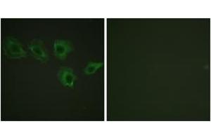 Immunofluorescence analysis of A549 cells, using MYPT1 (Phospho-Thr696) Antibody.