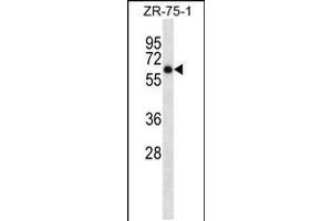 Image no. 1 for anti-Arylsulfatase D (ARSD) (AA 502-532), (C-Term) antibody (ABIN5530398)