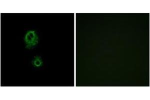 Image no. 2 for anti-MAS-Related GPR, Member G (Mrgprg) (AA 231-280) antibody (ABIN1535776)