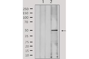 anti-Fukutin Related Protein (FKRP) (N-Term) antibody