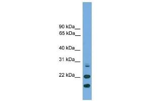 Image no. 1 for anti-ASF1 Anti-Silencing Function 1 Homolog A (S. Cerevisiae) (ASF1A) (N-Term) antibody (ABIN929054)