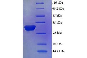 Id2 Protein (AA 1-134, full length) (His-SUMO Tag)