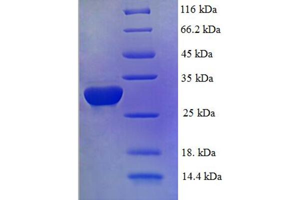 Id2 Protein (AA 1-134, full length) (His-SUMO Tag)