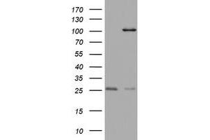 Image no. 2 for anti-Chromosome 3 Open Reading Frame 15 (C3orf15) (AA 1-313) antibody (ABIN2715591)