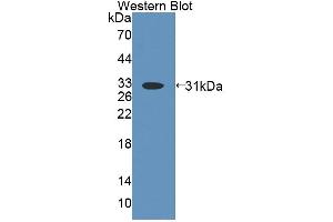 Image no. 3 for anti-ATP-Binding Cassette, Sub-Family D (Ald), Member 4 (ABCD4) (AA 356-606) antibody (ABIN5013197)