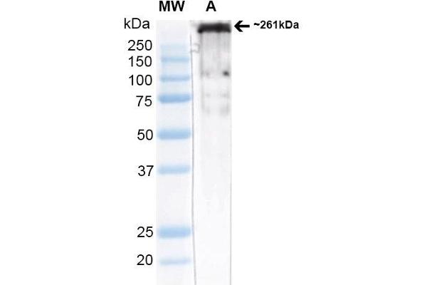 CACNA1H Antikörper  (AA 1019-1293) (FITC)