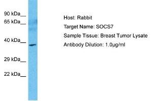 Image no. 1 for anti-Suppressor of Cytokine Signaling 7 (SOCS7) (N-Term) antibody (ABIN2785525)