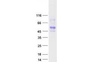Image no. 1 for STEAP Family Member 3, Metalloreductase (STEAP3) (Transcript Variant 2) protein (Myc-DYKDDDDK Tag) (ABIN2732841)