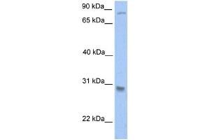 Image no. 1 for anti-Glutathione S-Transferase theta 1 (GSTT1) (C-Term) antibody (ABIN2783392)