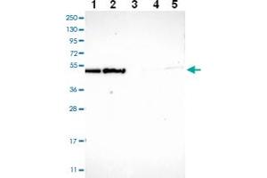 Image no. 1 for anti-ECSIT (ECSIT) antibody (ABIN5576979)
