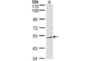 anti-Dual Specificity Phosphatase 10 (DUSP10) (C-Term) antibody