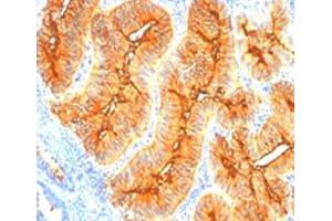 Image no. 1 for anti-Temporarily Assigned Gene Name Family Member (TAG-72) antibody (ABIN5589185)