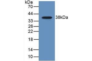 CCL22 Antikörper  (AA 25-93)