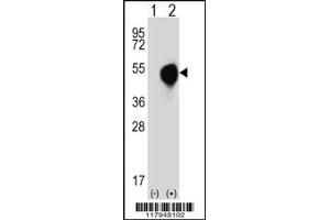 Western Blotting (WB) image for anti-Dom-3 Homolog Z (DOM3Z) antibody (ABIN2160680)