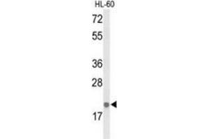 Image no. 1 for anti-Interleukin 26 (IL26) (AA 94-124), (Middle Region) antibody (ABIN952926)