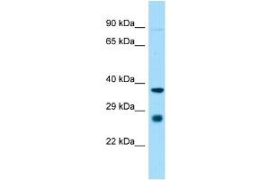 anti-ST8 alpha-N-Acetyl-Neuraminide alpha-2,8-Sialyltransferase 1 (ST8SIA1) (Middle Region) antibody