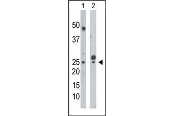 anti-Uridine-Cytidine Kinase (UCK) (AA 18-48), (N-Term) antibody