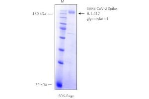 SARS-CoV-2 Spike Protein (B.1.617.1 - kappa) (rho-1D4 tag)