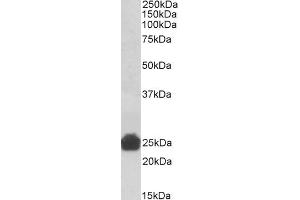 Image no. 1 for anti-Glutathione S-Transferase alpha 3 (GSTA3) (Internal Region) antibody (ABIN5539833)