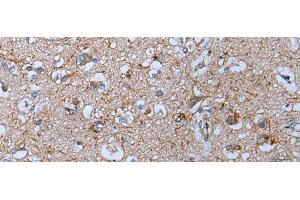 Immunohistochemistry of paraffin-embedded Human brain tissue using YPEL5 Polyclonal Antibody at dilution of 1:60(x200)