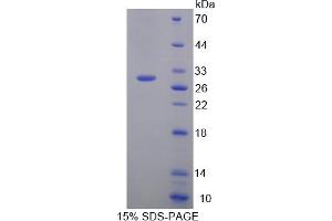 Image no. 1 for Plexin B1 (PLXNB1) (AA 1598-1849) protein (His tag) (ABIN6238197)