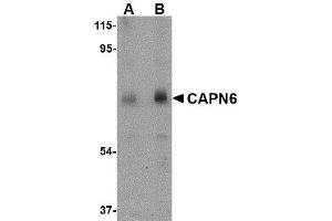 Image no. 2 for anti-Calpain 6 (CAPN6) (C-Term) antibody (ABIN499521)
