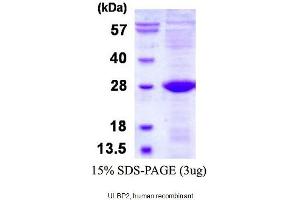 Image no. 1 for UL16 Binding Protein 2 (ULBP2) (AA 26-216) protein (His tag) (ABIN1888856)