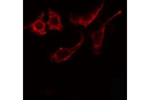 Image no. 1 for anti-Arylsulfatase E (ARSE) antibody (ABIN6256951)