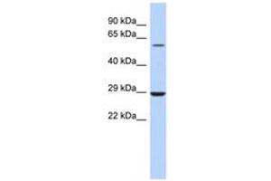 Image no. 1 for anti-Lysophosphatidylcholine Acyltransferase 1 (LPCAT1) (AA 323-372) antibody (ABIN6743531)