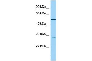 Image no. 1 for anti-Cytochrome P450, Family 4, Subfamily B, Polypeptide 1 (CYP4B1) (C-Term) antibody (ABIN2777007)