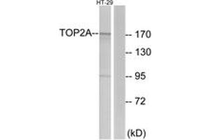 Image no. 1 for anti-Topoisomerase (DNA) II alpha 170kDa (TOP2A) (AA 1-50) antibody (ABIN1533609)