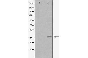 Image no. 1 for anti-Kallikrein 7 (KLK7) (Internal Region) antibody (ABIN6262851)