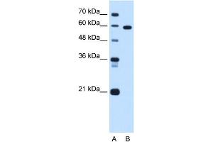 Image no. 4 for anti-T-Box 15 (TBX15) (C-Term) antibody (ABIN2783113)