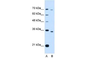 Image no. 1 for anti-PHD Finger Protein 6 (PHF6) (Middle Region) antibody (ABIN925979)