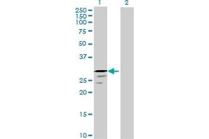 Image no. 1 for anti-Protease, serine, 58 (PRSS58) (AA 1-241) antibody (ABIN530740)
