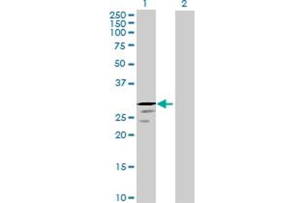 anti-Protease, serine, 58 (PRSS58) (AA 1-241) antibody