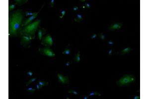 Immunofluorescence (Cultured Cells) (IF (cc)) image for anti-Transcription Termination Factor, RNA Polymerase I (TTF1) (AA 201-300) antibody (ABIN728713)