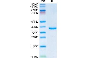 IGFBP2 Protein (His tag)