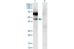 Image no. 2 for anti-Colony Stimulating Factor 2 Receptor, Alpha, Low-Affinity (Granulocyte-Macrophage) (CSF2RA) (AA 1-400) antibody (ABIN514675)