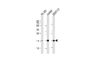 Image no. 2 for anti-Small Ubiquitin Related Modifier 3 (SUMO3) antibody (ABIN387787)