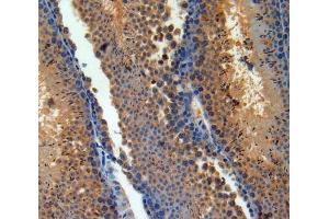 Image no. 2 for anti-Adenylate Cyclase Activating Polypeptide 1 (Pituitary) (ADCYAP1) (AA 1-175) antibody (ABIN2925465)