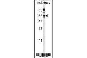 Image no. 2 for anti-Kallikrein 8 (KLK8) (AA 143-172) antibody (ABIN652199)